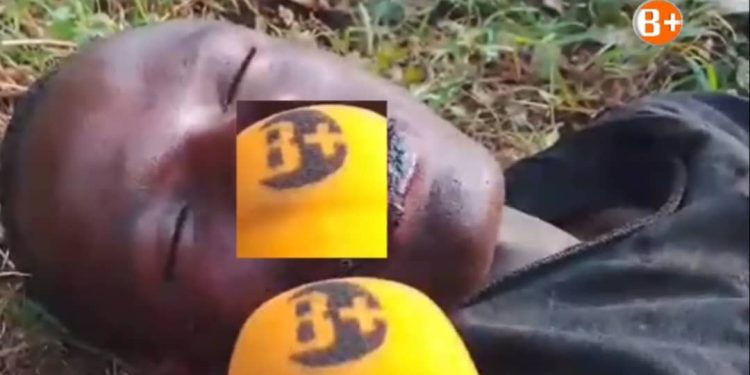Rusizi: Umuturage arashinja abanyerondo kumukubita bakamugira intere bamwitiranyije n’igisambo cyari cyibye inkoko
