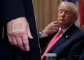Hasobanuwe impamvu Perezida Donald Trump agaragara kenshi afite igipfuko ku kiganza