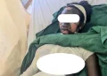 Ngororero: Umukoresha arakekwaho gutwikisha amazi ashyushye umukozi we amuziza ko yatinze guteka