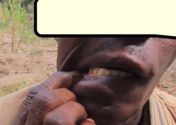 Ruhango: Yafashe umugabo we ari kumuca inyuma amukura iryinyo