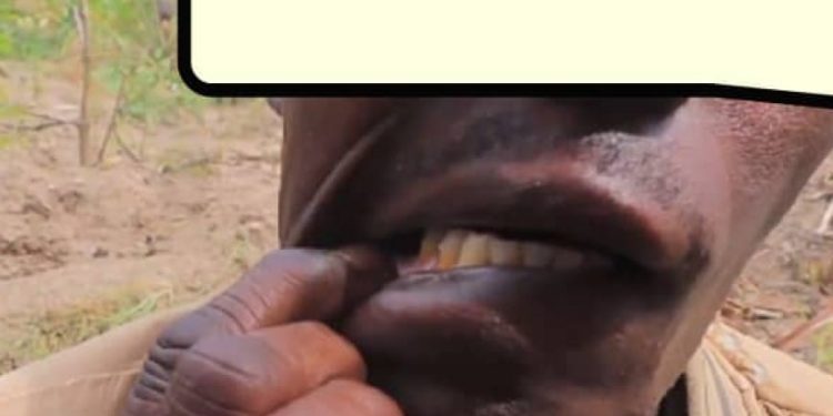Ruhango: Yafashe umugabo we ari kumuca inyuma amukura iryinyo